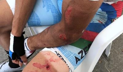 Yığmamızın üzvü velosipeddən yıxılıb əzildi – İKİ FOTO