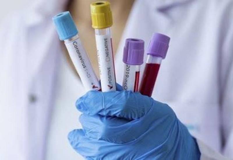 Koronavirus bəlası bu tarixdə bitəcək