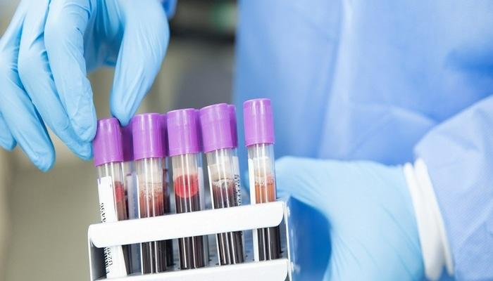 Koronavirus müəmmaları: Yenidən yoluxmaq mümkündür?
