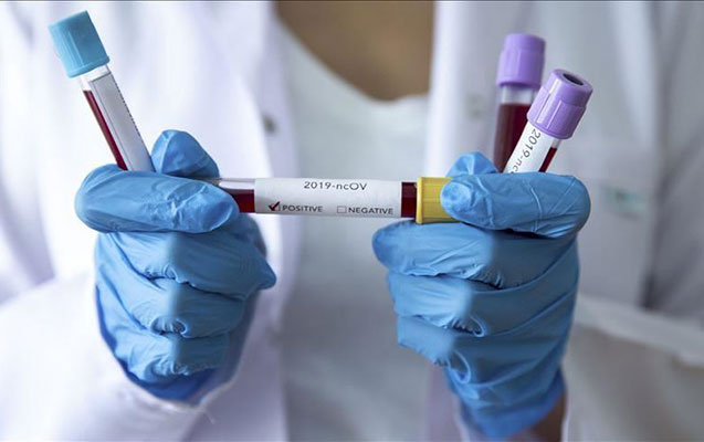 Azərbaycanda daha 70 nəfərdə koronavirus aşkarlandı