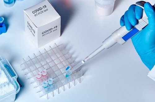 Azərbaycanda karantin rejimi yalnız bu halda yumşaldılacaq