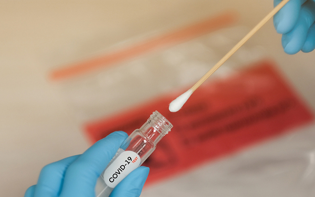 Azərbaycanda 113 nəfərdə koronavirus aşkarlandı, 1 nəfər öldü