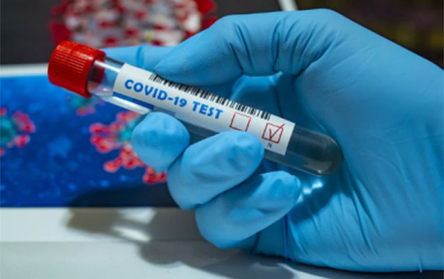Azərbaycanda daha 140 nəfərdə koronavirus aşkarlandı
