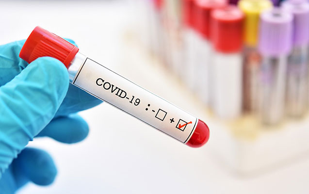 230 nəfər koronavirusa yoluxdu, ikisi vəfat etdi