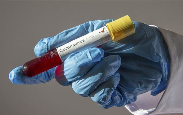 Daha 262 nəfər koronavirusa yoluxdu, 2 nəfər öldü