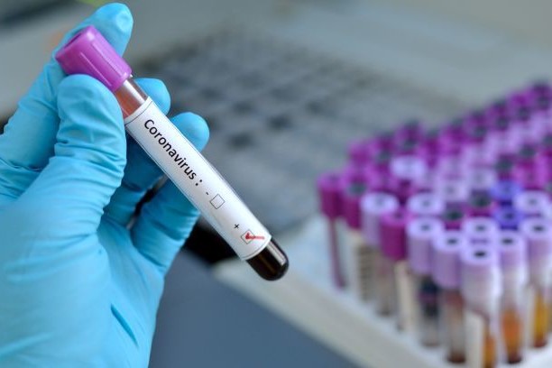 Gürcüstan yığmasında koronavirus şoku -