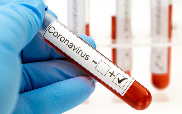 588 nəfər koronavirusa yoluxdu, 7 pasiyent öldü