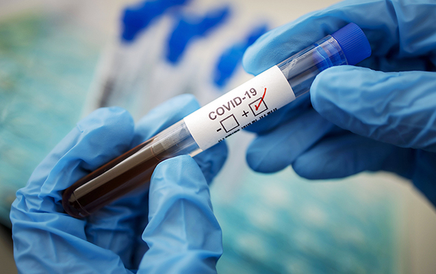 542 nəfərdə koronavirus aşkarlandı, 9 pasiyent öldü