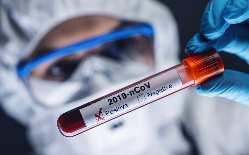 Azərbaycanda daha 280 nəfərdə koronavirus aşkarlandı