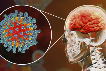 Koronavirus beyinə necə təsir edir? - ARAŞDIRMA