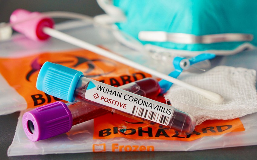 Azərbaycanda aktiv koronavirus xəstələrinin və ölənlərin sayı azaldı