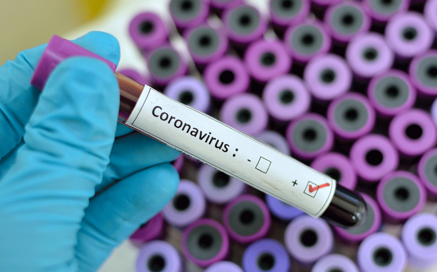 Azərbaycanda daha 146 nəfər koronavirusa yoluxdu - ölən yoxdur