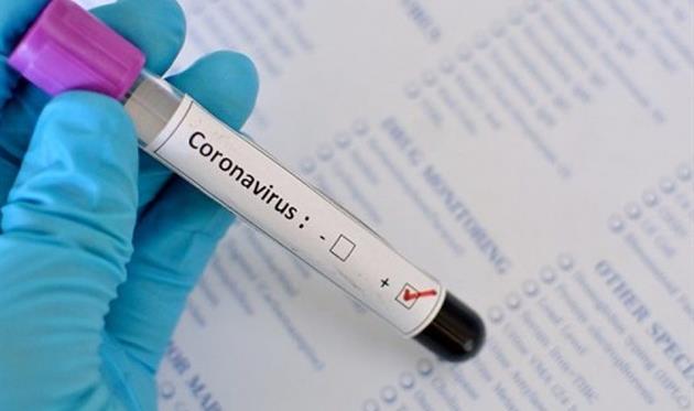 19 futbolçuda koronavirus aşkarlandı - Fransa klubunda