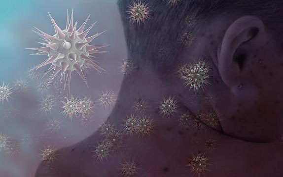 GÜNÜN QORXULU XƏBƏRİ - Yeni yoluxucu virus yayılır