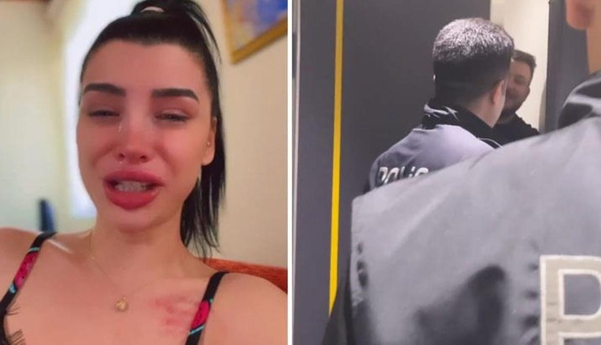 Futbolçu sevgilisi tərəfindən döyüldü, ağlayaraq VİDEO+FOTO paylaşdı
