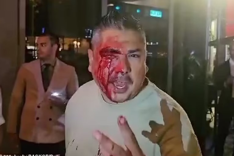 Restoranda iki məşhurun şəklini çəkməyə cəhd etdi, döyüldü - FOTOLAR
