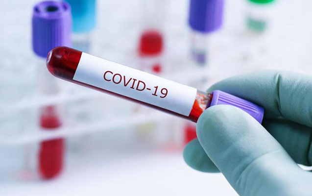 Azırbaycanda koronavirusa yoluxanların yeni sayı