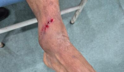 “Neftçi” - “Sabah” matçının ən QALMAQALLI OLAYI -