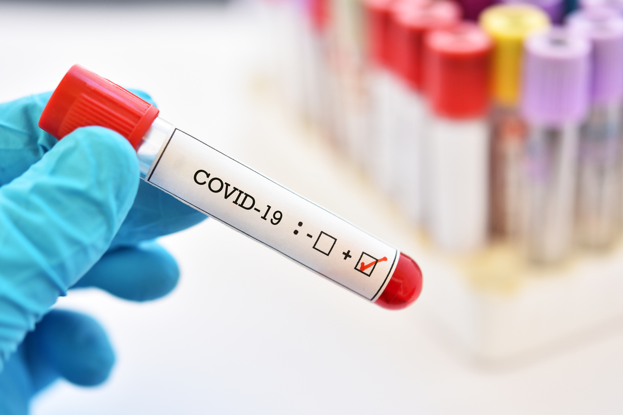 Azərbaycan yığmasının 3 oyunçusunda koronavirus aşkarlandı