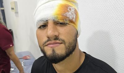 Rayonda futbolçunun gözünü bu hala saldılar -