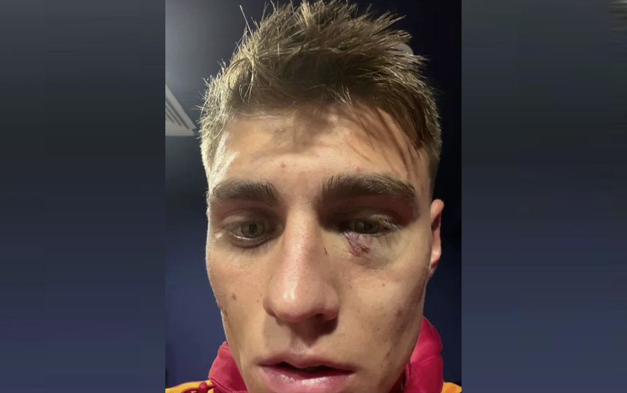 Tribunadan atılan alışqan futbolçunu bu hala saldı - VİDEO+FOTO