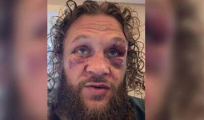 “Deyəcək bir söz yoxdur, yaxşıca döyüldüm, mən buna cürət etdim” - VİDEO