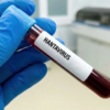 Hantavirus insandan insana nadir halda keçir - AÇIQLAMA