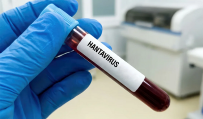 Hantavirus insandan insana nadir halda keçir - AÇIQLAMA
