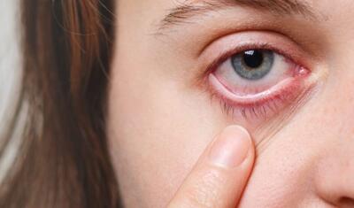 Bu problem insultun əlamətidir