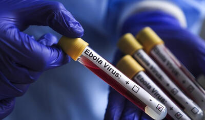DÇ-2026-nın problemi - Ebola müayinə mərkəzləri yaradacaqlar